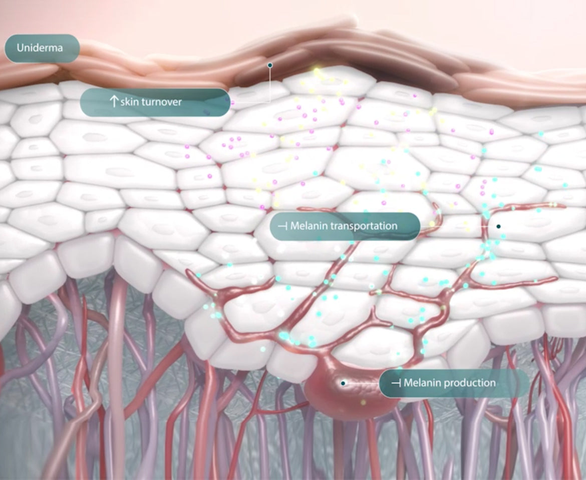 Understanding the causes of Hyperpigmentation 