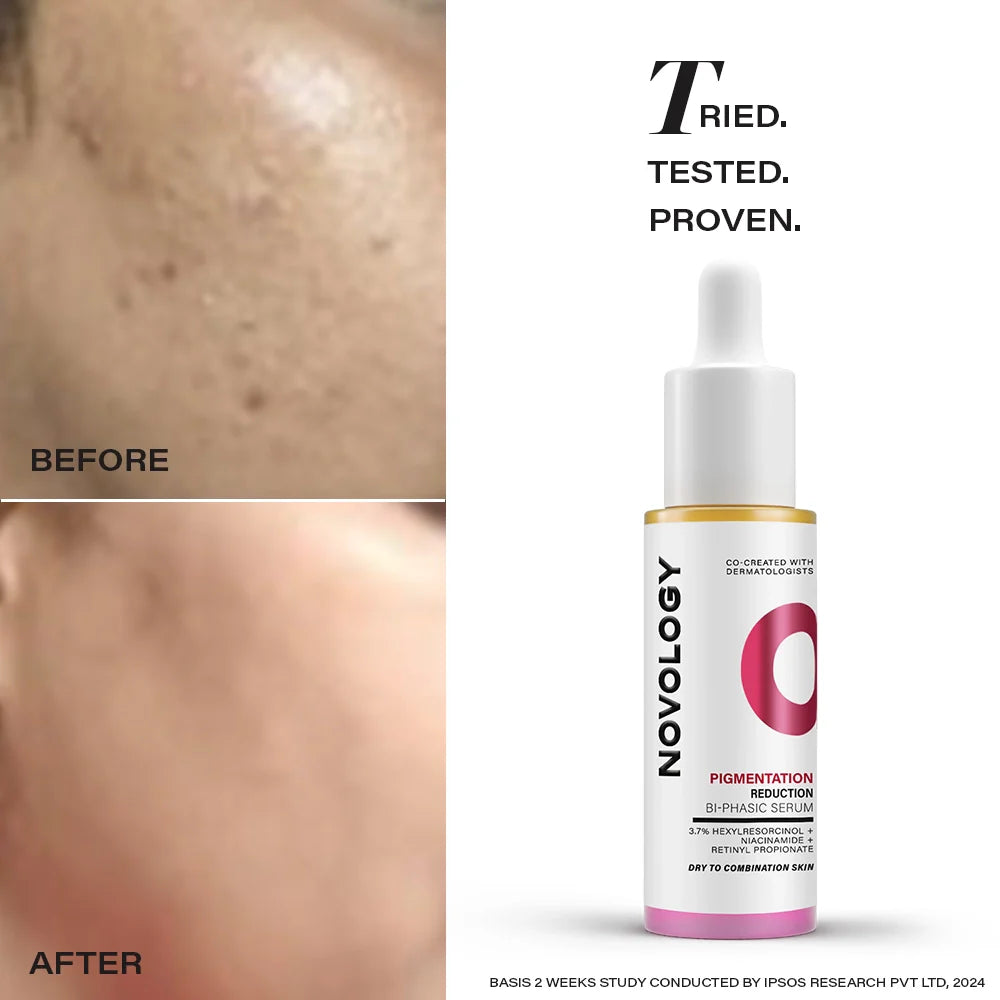 Pigmentation Reduction Bi-Phasic Serum