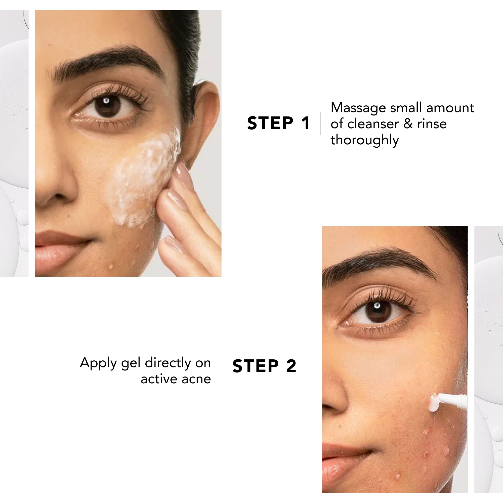 Acne Spot Correction Regime