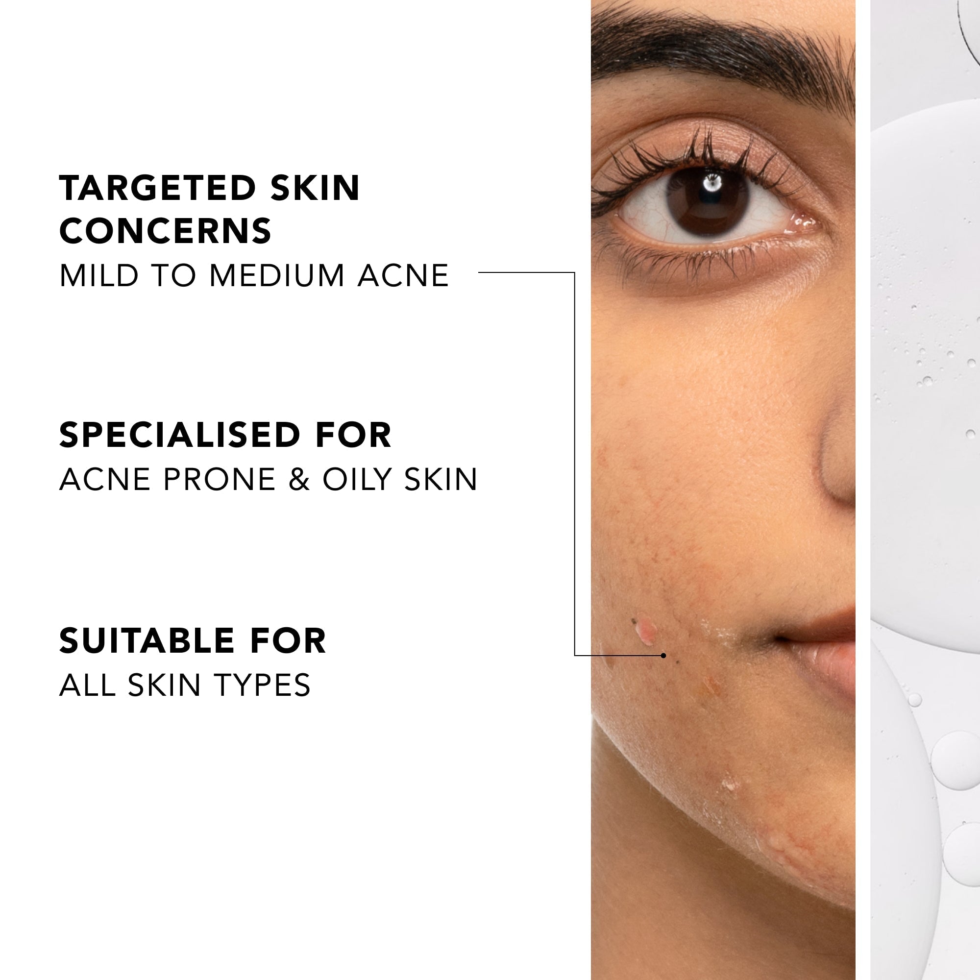 Acne-Prone Skin Regime